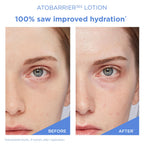 ATOBARRIER 365 LOTION