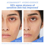 ATOBARRIER 365 HYDRO ESSENCE