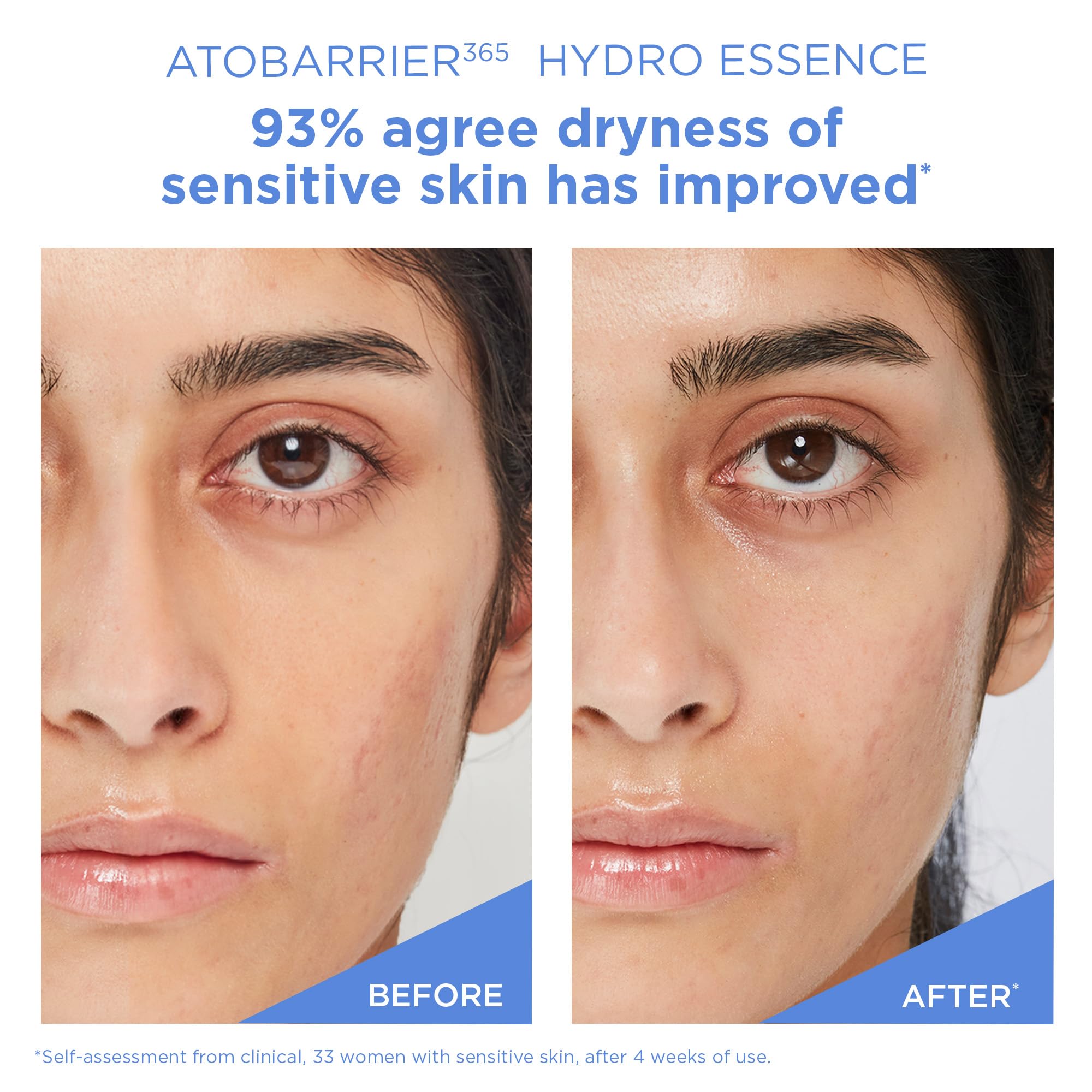 ATOBARRIER 365 HYDRO ESSENCE
